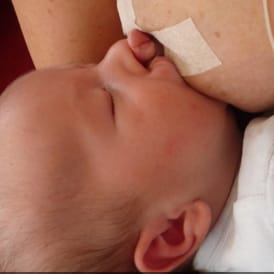 Allaitement chez les bébés porteurs de fentes